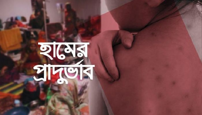 হামের প্রাদুর্ভাবে ২৪ ঘণ্টায় আরও ১১ জনের মৃত্যু